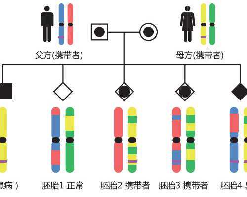 输卵管不孕的症状治疗,多囊怀孕如何自然怀孕