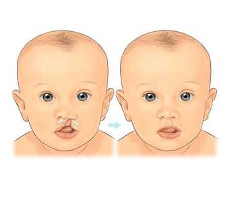 济南代生孩子流程,【济南省立医院供卵试管婴儿】多囊促排第三次终成，前期